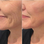 Appareil Lifting Visage LED 7 Couleurs | Eliscence