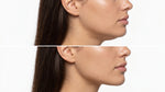 Bandeau Lifting Visage V-Line | Eliscence